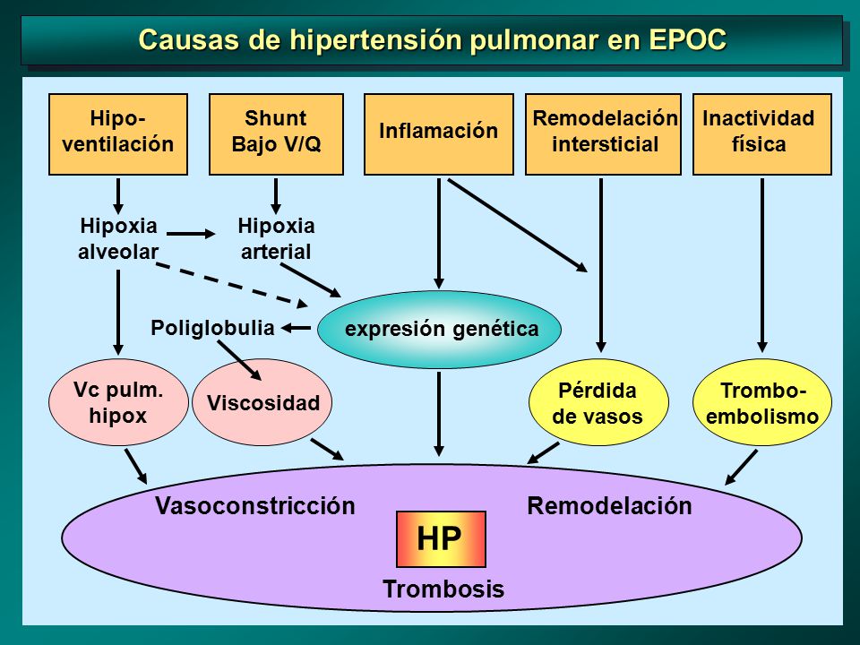 Etiologia de la hipertension arterial pulmonar